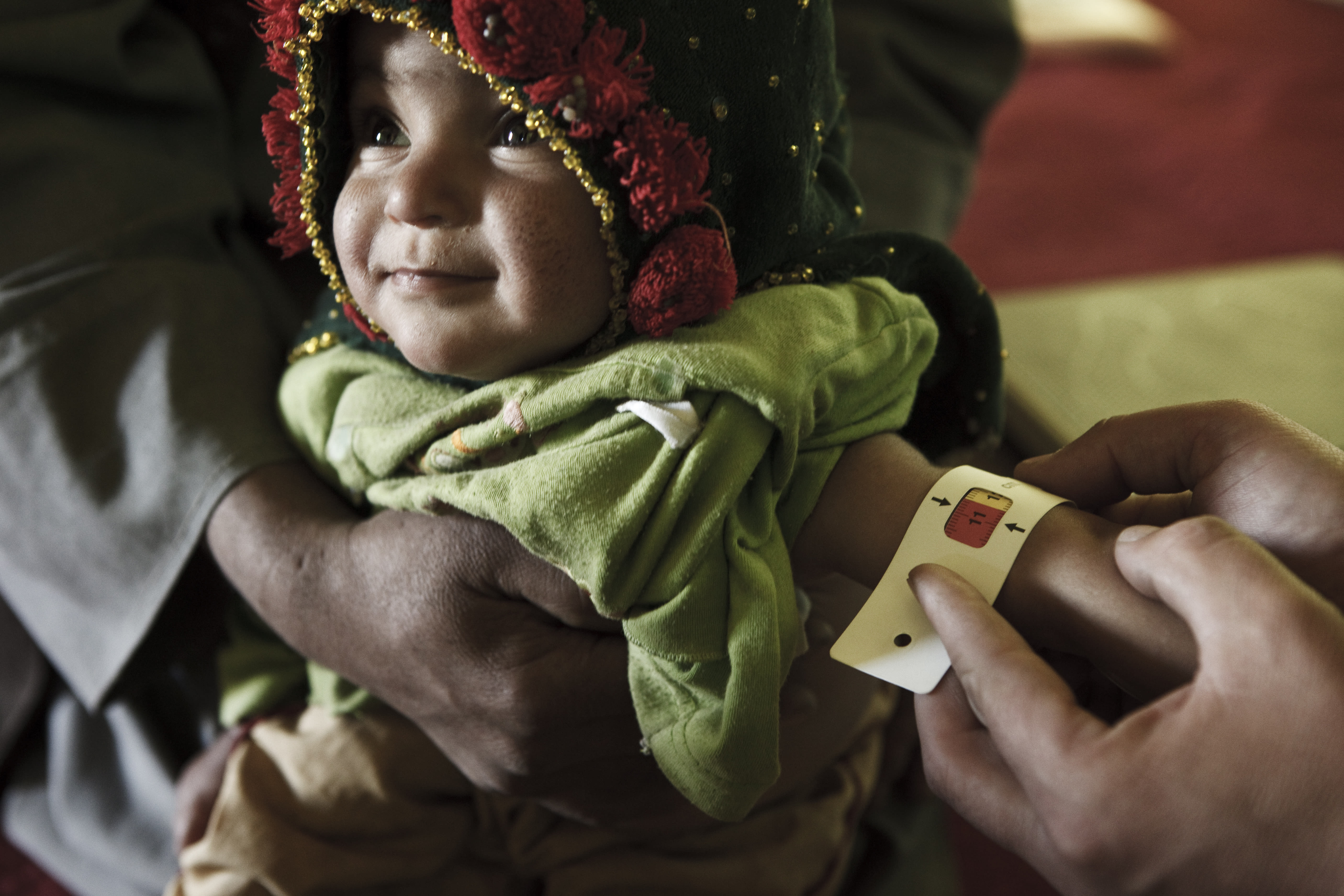 NADERA, 17 MOIS. ( TEMOIGNAGE ET PHOTOS AVANT TRAITEMENT)